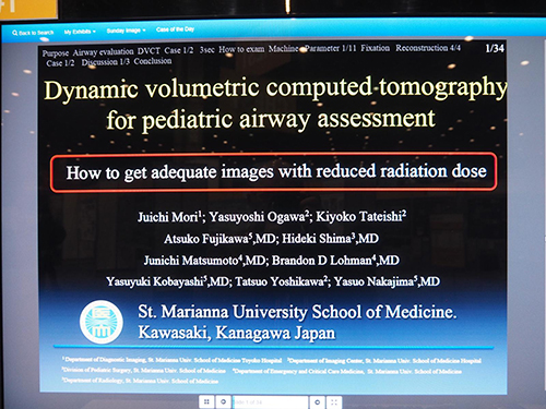 Dynamic Volumetric Computed Tomography for Pediatric Airway Assessment: How to Get Adequate Images with Reduced Radiation Dose