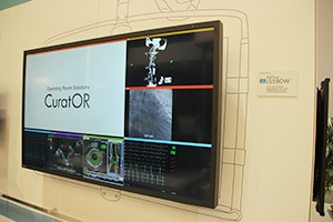 58型手術室向け画像表示モニタ「RadiForce LS580W」