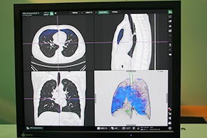 SYNAPSE VINCENTの肺換気計測アプリケーション