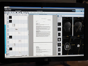 DICOMとPDFなど異なる形式のデータを同時に表示するCCA