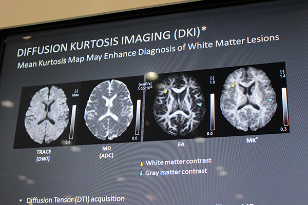 拡散イメージング “diffusion kurtosis imaging（DKI）”