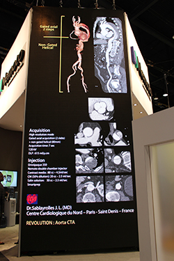 GEの最新CT「Revolution CT」による造影画像をプロトコールとともに紹介