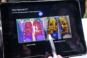Spectral解析による肺の換気機能評価