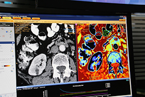 実効原子番号を使い作成したイメージ（右）では，物質が明瞭に弁別される。