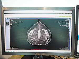 iNteract+ iSHAREのリスト画面からiNteract+ iEMVでマンモグラフィ画像を表示