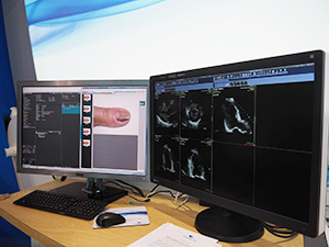 iNteract+ iREVIEWによる診療情報の一元管理