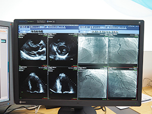 4D画像表示にも対応するiNteract+ iREVIEW