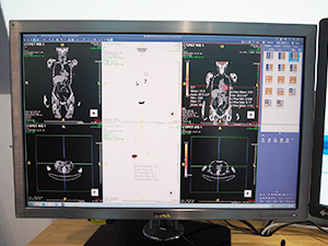 CTとPETのフュージョン機能