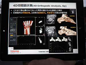 関節の動きを解析する4D骨関節計測
