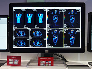 新製品の30インチ，4メガピクセルの医用画像ワイドモニタ「Coronis Fusion 4MP DL」