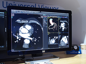 3D解析機能が強化されるCentricity Universal Viewer