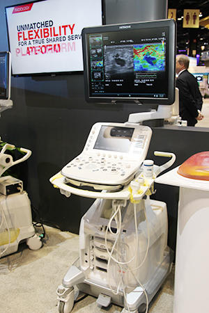 大幅に臨床機能を強化した「ARIETTA」