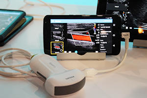 初披露された超音波診断装置「Lumify」