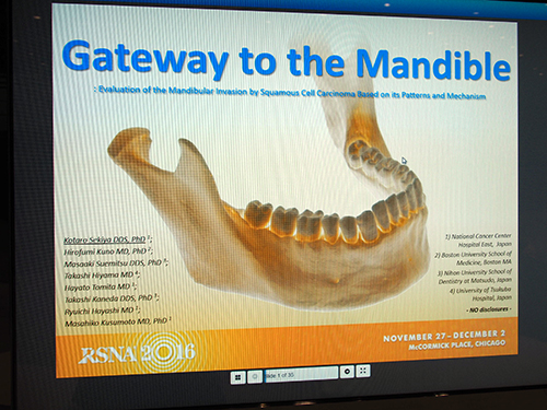 Gateway to the Mandible: Evaluation of the Mandibular Invasion by Squamous Cell Carcinoma Based on its Patterns and Mechanism