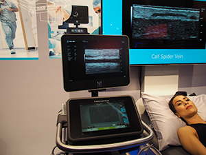 最小分解能30μmで超高精細画像の描出が可能