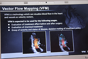 詳細な心機能評価を行える“Vector Flow Mapping（VFM）”