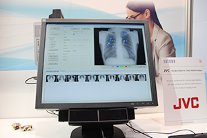 X線胸部画像への視線計測装置の応用研究