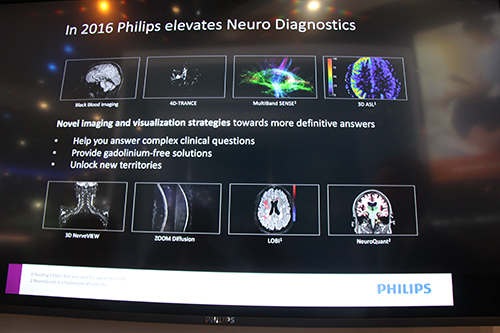 2016年度中に提供予定の脳神経領域アプリケーション