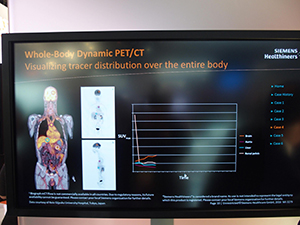 静止画像と動態画像が得られる“Whole Body Dynamic PET/CT”