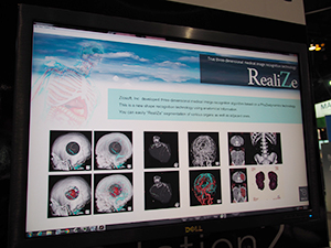 三次元医用画像認識技術“RealiZe”を利用したアプリケーションを紹介