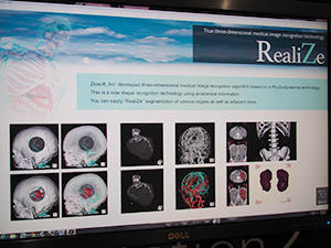 新しい三次元医用画像認識技術「RealiZe」