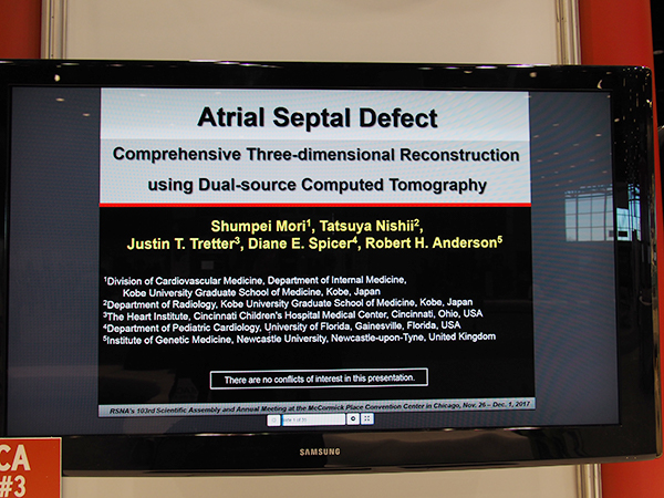 CA114-ED-X Atrial Septal Defect: Comprehensive Three-dimensional Reconstruction Using Dual-source Computed Tomography 森　俊平氏（神戸大学）ほか