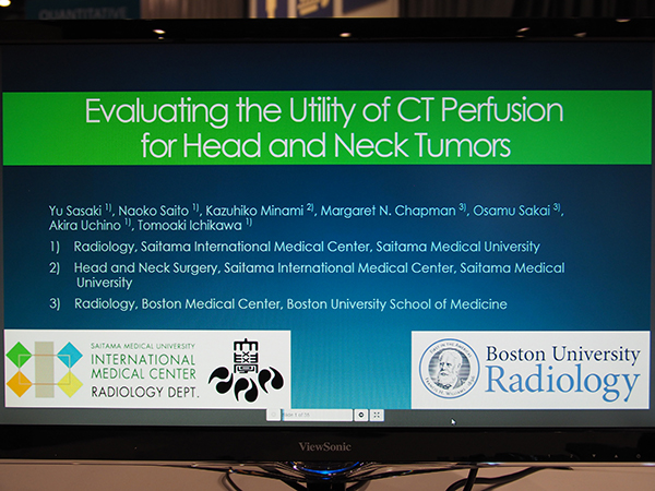NR178-ED-X Evaluating the Utility of CT Perfusion for Head and Neck Tumors 佐々木　悠氏（埼玉医科大学国際医療センター）ほか