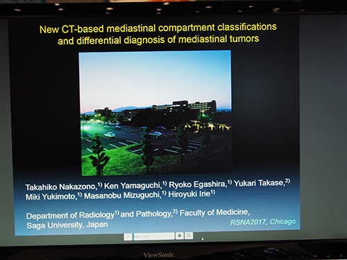 CH134-ED-X New CT-Based Mediastinal Compartment Classifications and Differential Diagnosis of Mediastinal Tumors 中園貴彦氏（佐賀大学）ほか