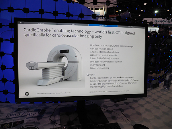 米国・欧州で展開する心臓専用CT「CardioGraphe」