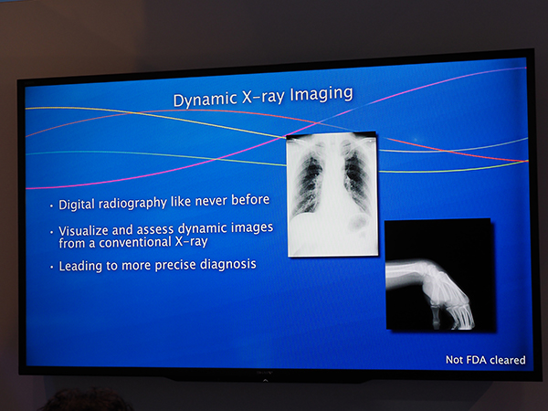開発が進む“Dynamic X-ray Imaging”