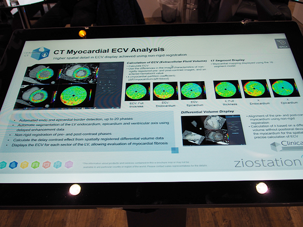 CTでのECV解析や遅延造影解析に対応して心臓のワンストップショップ検査に対応