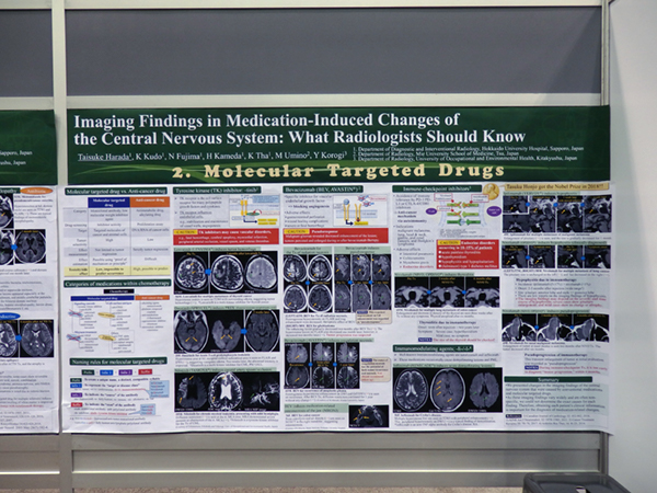 Imaging Findings in Medication-Induced Changes of the Central Nervous System: What Radiologists Should Know 原田太以佑氏（北海道大学）ほか