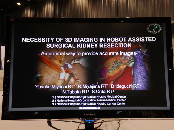 Necessity of 3D Imaging in Robot Assisted Surgical Kidney Resection: An Optimal Way to Provide Accurate Images 宮地優介氏（九州医療センター）ほか