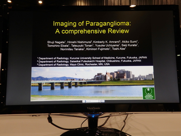 Imaging of Paraganglioma in Various Organs: A Comprehensive Review 長田周治氏（久留米大学）ほか