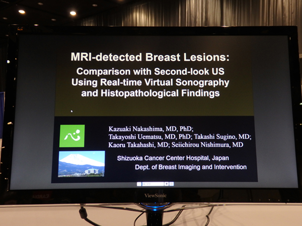 MRI-Detected Breast Lesions: Comparison with Second-look US Using Real-time Virtual Sonography and Histopathological Findings 中島一彰氏（静岡がんセンター）ほか