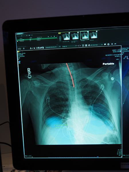 胸部X線画像ではサードパーティのAIアルゴリズムで解析した結果をオーバーレイで表示