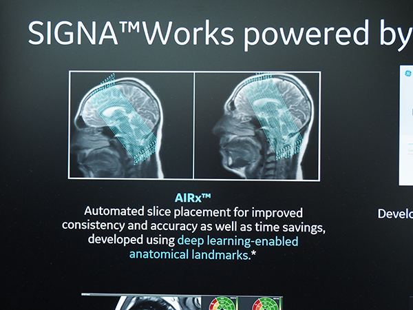 “Edison Apps”の1つで頭部MRIを自動化する“AIRx”（W.I.P）