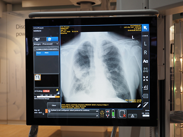 気胸を検出する“Critical Care Suite”（FDA未承認）