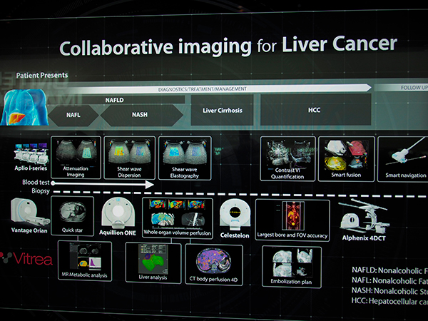 Oncology（肝臓がん）でのCollaborative imaging