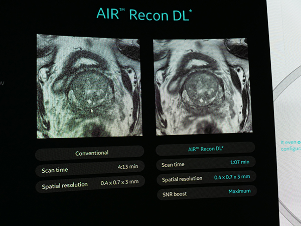 “AIR Recon DL”（開発中，技術参考展示）と従来画像との比較
