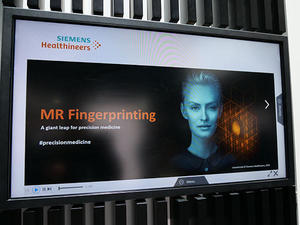 製品への実装を開始するMR FingerprintingをPR