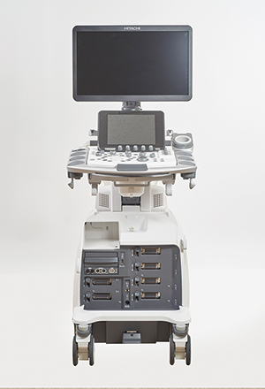 超音波診断装置「ARIETTA 750」