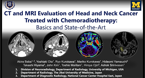 HNEE-20 CT And MRI Evaluation of Head and Neck Cancer Treated with Chemoradiotherapy: Basics and State-of-the-Art 馬場　亮 氏（東京慈恵会医科大学）ほか
