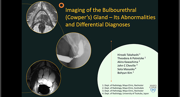 Imaging of the Bulbourethral （Cowper's） Gland - Its Abnormalities And Differential Diagnosis 高橋宏彰 氏（メイヨークリニック）ほか