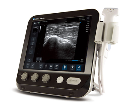 在宅医療などで威力を発揮する「SONIMAGE MX1」