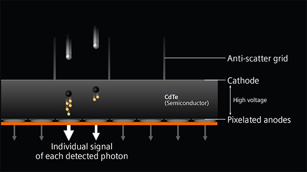 Photon-counting検出器の仕組み