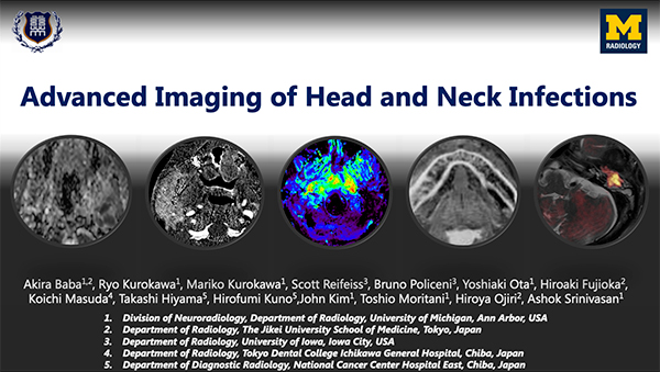 HNEE-46 Advanced Imaging of Head and Neck Infection 馬場　亮 氏（ミシガン大学/東京慈恵会医科大学）ほか