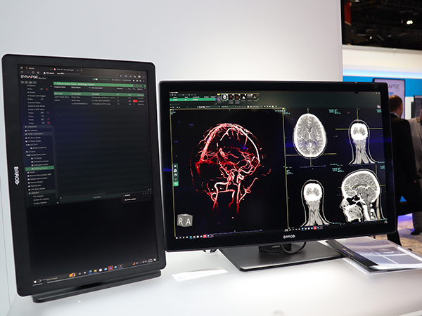 Microsoft Edgeを正式サポートしたPACS「SYNAPSE」の最新バージョン