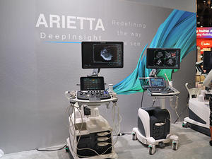 「ARIETTA 850 DeepInsight」（左）と「ARIETTA 650 DeepInsight」（右）