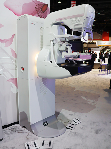 トモシンセシス対応のデジタルマンモグラフィ「AMULET Innovality」